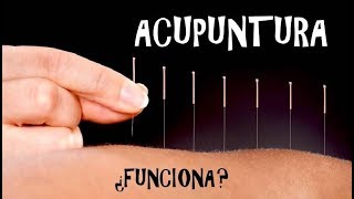 Acupuntura ¿Funciona o no [upl. by Aniled]