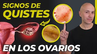 SI TIENES UNO DE ESTOS SÍNTOMAS PUEDES TENER QUISTES EN LOS OVARIOS  ¿CURAR EL OVARIO POLIQUÍSTICO [upl. by Nnahteb]