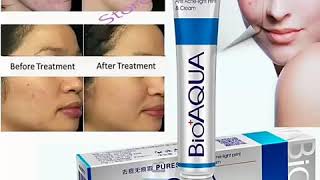 BioAqua Anti Acne Cream [upl. by Cirted]