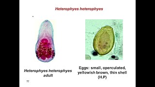 Heterophyes Heterophyes  Life cycle Disease Heterophyiasis Symptoms Diagnosis Treatment [upl. by Celka111]