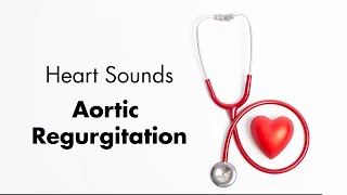 Aortic Regurgitation  Heart Sounds  MEDZCOOL [upl. by Reinaldo]