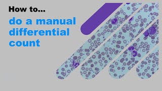 How to do a manual differential count [upl. by Neggem]