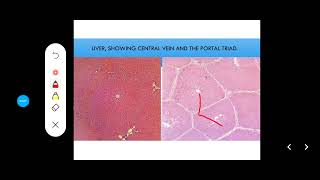 Histology Slides Series Episode 12  Accessory Organs of Digestion Liver Pancreas Gallbladder [upl. by Ohcirej741]