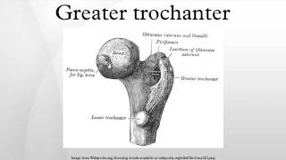 Greater trochanter [upl. by Birmingham707]