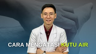 Cara Mengatasi Kutu Air [upl. by Torrie]