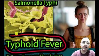 Typhoid Fever Symptoms Causes and treatment [upl. by Bluefarb]