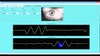 Pupil detection  Python and OpenCV  Videonistagmography System [upl. by Sialac]