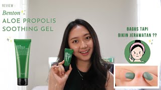 Review Benton Aloe Propolis Soothing Gel [upl. by Burrus274]