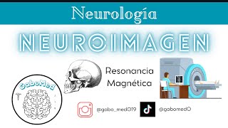 Neuroimagen  Resonancia Magnética [upl. by Zelig]