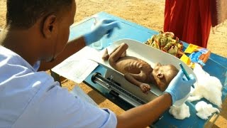 Malnutrition at record high in droughthit Somalia ICRC [upl. by Alesram]