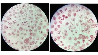 LeptoteneZygotenePachyteneDiplotene amp Diakinesis stages of meiosis with identifying characters [upl. by Cos73]