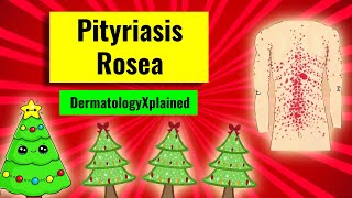 Pityriasis rosea christmastree rash clinical features associations histology and management [upl. by Wilder116]