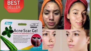 Acne Scar GelAcne and acne scar removal creamRemoves small black spots and smooths the face cream [upl. by Enautna487]