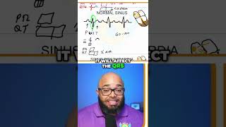 Understanding Hyperkalemia EKG Changes You Must Know [upl. by Akinhoj]