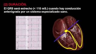 CURSO DE ELECTROCARDIOGRAFIA 28  QRS [upl. by Ynamrej182]