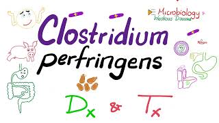 Clostridium perfringens Diagnosis and Treatment  Microbiology 🧫 amp Infectious Diseases [upl. by Nahtaj687]