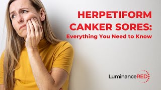 Herpetiform Canker Sores Everything You Need to Know [upl. by Cullie]