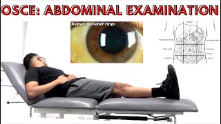 OSCE Abdominal Examination [upl. by Nickolas822]