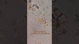 entamoeba histolytica locomotion pseudopodia amazing [upl. by Byler]