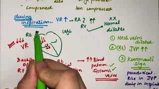 Cardiac tamponade  pathophysiology  clinical features  MEDICINE with DR SHAMAMA [upl. by Sudnor]