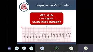 ACLS  Bradiarritmias Taquiarritmias y Paro Cardiorespiratorio [upl. by Yekciv]