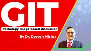 Pathology Image based discussion  GIT by Dr Devesh Mishra [upl. by Liebowitz]