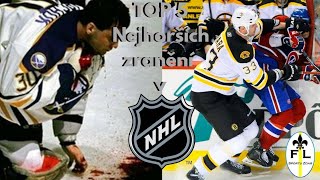 TOP 5 nejhorších zranění v hokeji NHL [upl. by Euqinom]