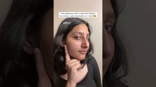 Best anti acne face wash for indian skin [upl. by Rialc67]