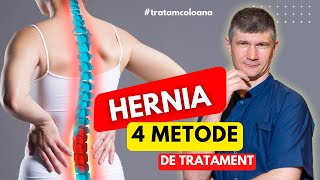 Hernia de disc 4 metode de tratament Pe care ați încercato [upl. by Shepherd]