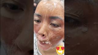 Get Spotless amp Glowing Skin  Remove Dark Spots amp Pigmentation In 7days beautiful shorts viral [upl. by Dysart287]