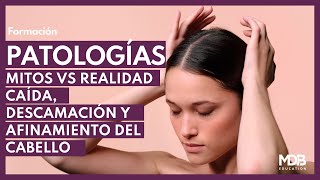 Aprende sobre Caída Descamación y Afinamiento de Cabello Mitos vs realidad Soluciones y Servicios [upl. by Einner]