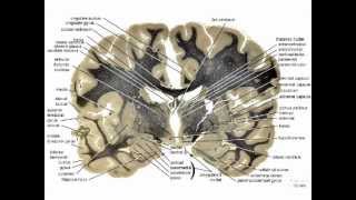 Neuropathology101Basic Neurohistology and NonNeoplastic lesionsmov [upl. by Abibah]