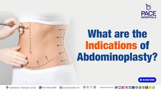 Abdominoplasty Indications  What are the Indications of Abdominoplasty  Abdominoplasty [upl. by Hera]