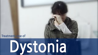 Generalized spasmodic dystonia  Spasmodic Torticollis  Dystonia  사경증 치료사례  근긴장이상증 [upl. by Barr231]