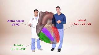 ECG for Beginners ECG Diagnosis of ST Elevation Myocardial Infarction STEMI [upl. by Screens]