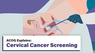 ACOG Explains Cervical Cancer Screening [upl. by Alon]