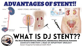 ADVANTAGES of DJ STENT  What is DJ STENT  How to remove STENT   Dr Rajiv Kumar Sethia [upl. by Ennaillek]