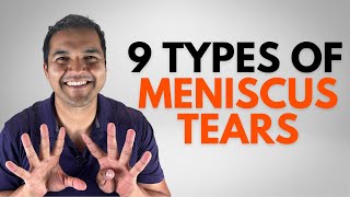 9 Types Of Meniscus Tears You Can Possibly Have amp What To Do Next [upl. by Adnalro422]