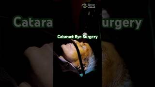 Cataract Surgery Procedure  Eye Surgery Procedure  Netram Eye Foundation [upl. by Osmond354]