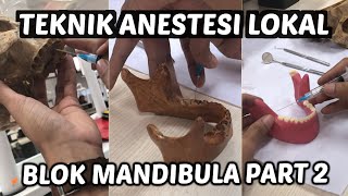 Teknik Anestesi Lokal Blok Mandibula PART 2 [upl. by Philippe]