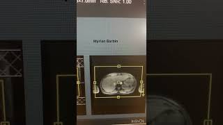 MRI Abdomen Exam diagnosticradiology radiology science mri mrimachine mritech [upl. by Favrot576]