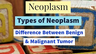 Neoplasm  Benign Neoplasm  Malignant Neoplasm  Difference of Benign and Malignant Tumor [upl. by Ashman]