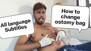 How to change ostomy bag nursing  Changing an ostomy bag  How to change Colostomy bag [upl. by Neerol]