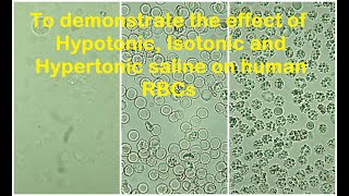 RBCs in Hypotonic Isotonic and Hypertonic solution Practical Lab [upl. by Verras]