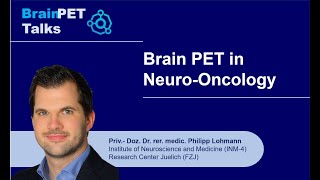 Dr Lohmann Neuro Oncology [upl. by Emerson]