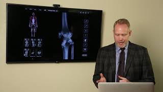 Posterior Cruciate Ligament PCL Injuries [upl. by Forkey]