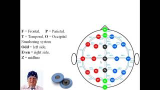 1020 electrode placement system used in electroencephalography EEG test [upl. by Cirri]