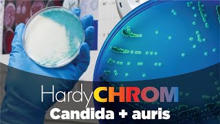 HardyCHROM™ Candida  auris chromogenic media [upl. by Lauree]