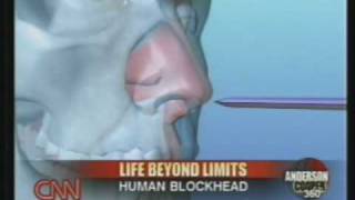 Human Blockhead Explained on CNN [upl. by Sauls150]