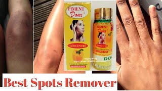 The Fastest Way to Get Rid of Dark Elbows Knuckles Knees and Acne SpotsPiment Doux Serum Review [upl. by Allsopp780]